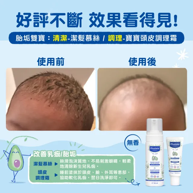 【Mustela 慕之恬廊】慕之幼 頭皮照護組(寶寶頭皮調理霜40ml+潔髮慕絲150ml 胎垢雙寶 清潔胎垢乳痂杏賽)