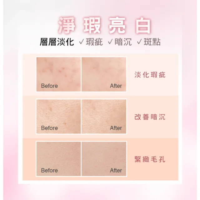 【St.Clare 聖克萊爾】杜鵑花酸淨肌煥白精華30ml(毛孔緊緻/淨瑕亮白/代謝粉刺)