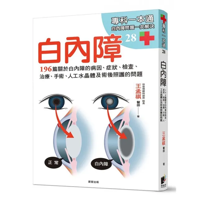 白內障：196篇關於白內障的病因、症狀、檢查、治療、手術、人工水晶體以及術後照護的問題