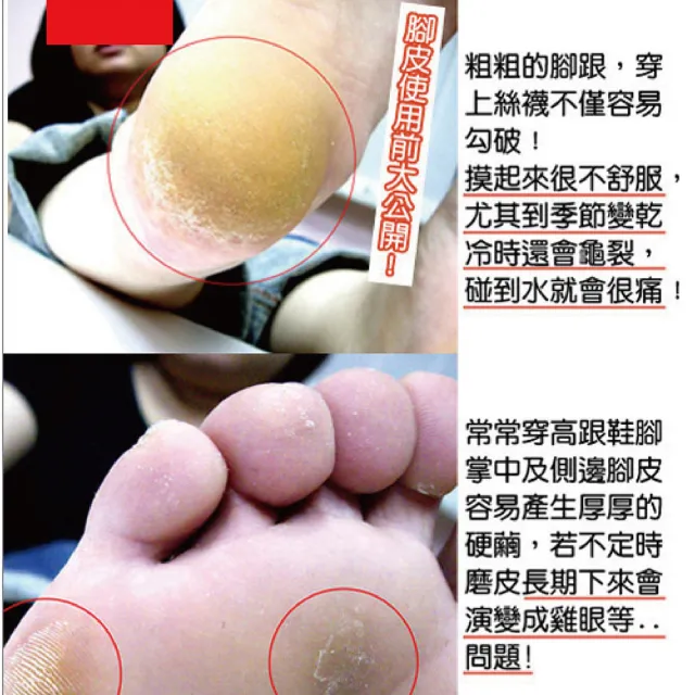 日本Beauty Foot 去角質足膜 25mlx2枚入(三入組)