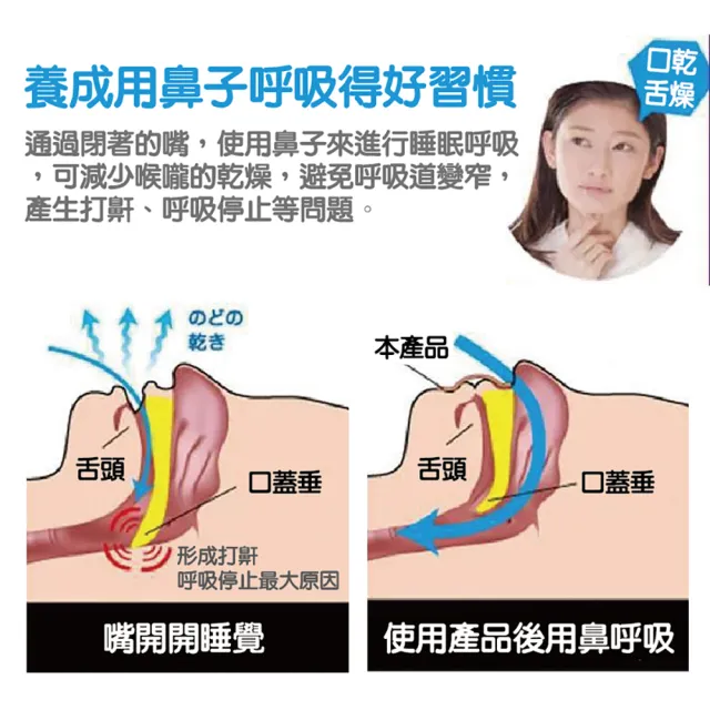 【沐日居家】閉嘴貼 防止口呼吸貼 嘴巴貼 嘴唇貼 兒童睡覺輔助貼(止鼾 呼吸貼 唇貼 止鼾貼 矯正貼)