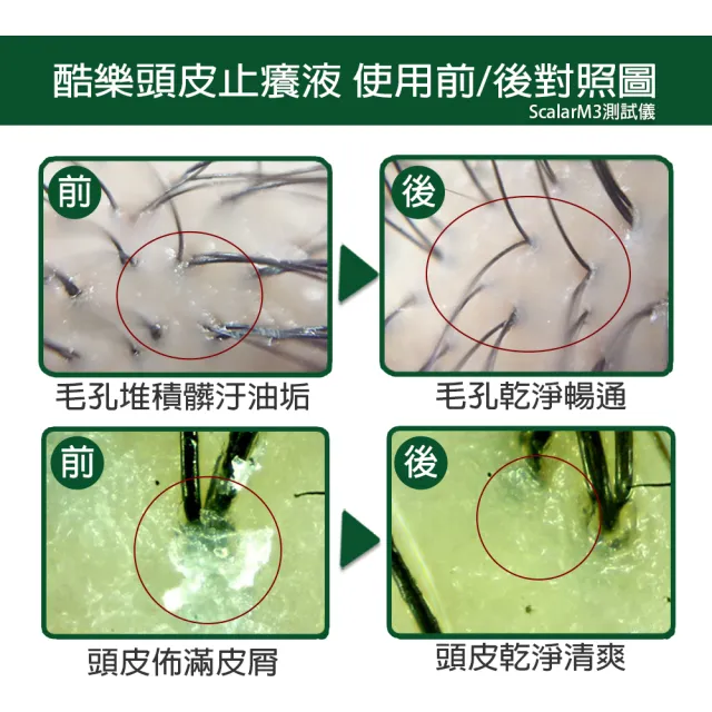 【arin 氧潤】酷樂頭皮止癢液120ml x3組(頭皮水/頭皮精華/頭皮去角質)