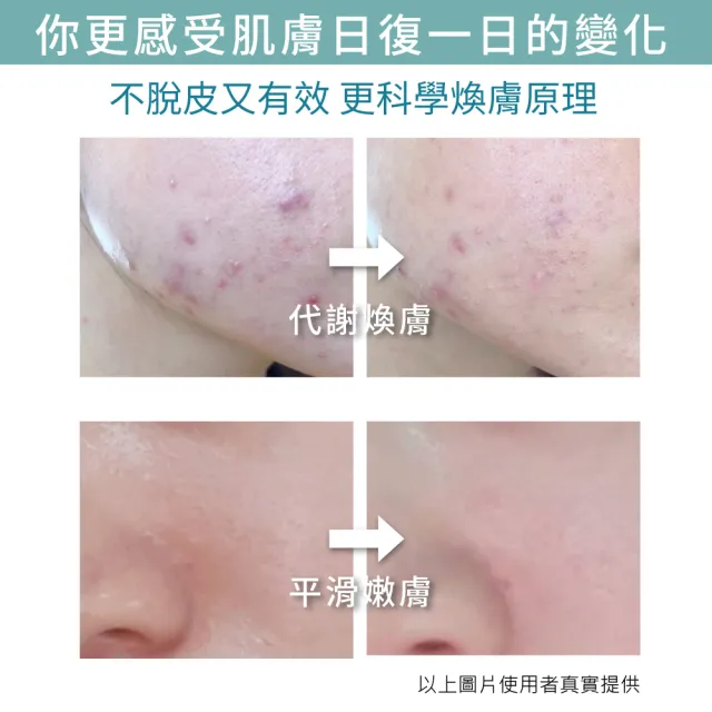 【UNICAT 變臉貓】水楊酸毛孔調理原液｜粉刺代謝 30ml(黑頭粉刺 細緻毛孔精華 平衡油脂 角質代謝 刷酸保養)