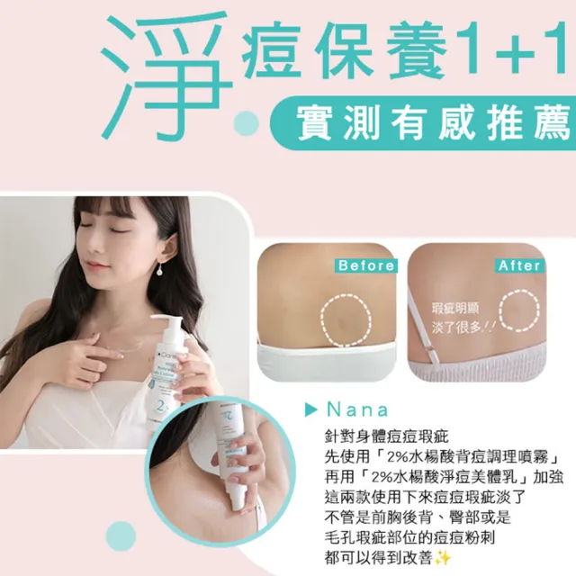 【St.Clare 聖克萊爾】2%水楊酸背痘調理噴霧100ml(去角質/淨痘/美背)