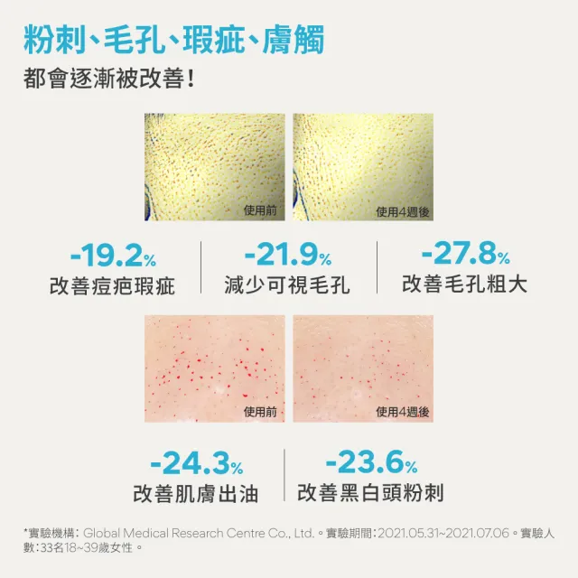 【INNISFREE】A醇淨膚超修護安瓶30ml-S.H.聯名限定版(去粉刺精華送7ml)