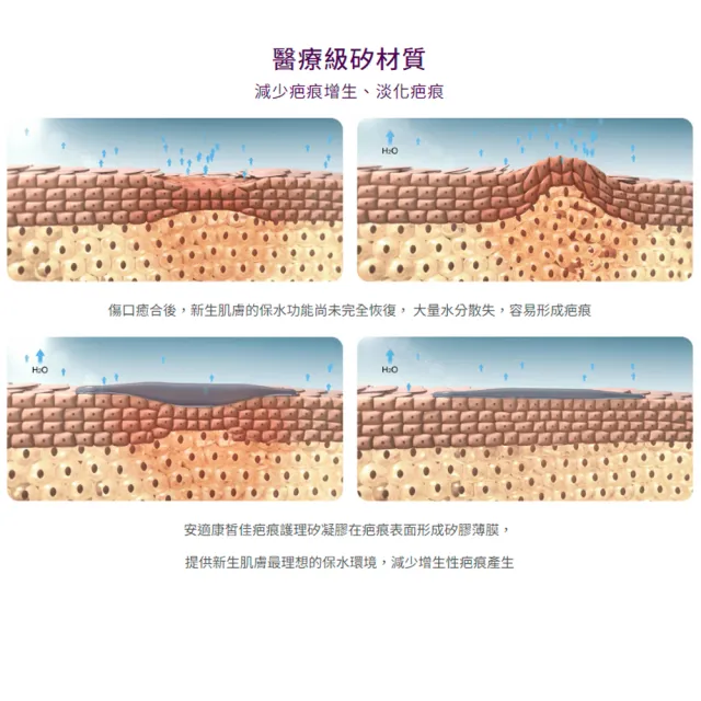 【安適康】皙佳疤痕護理矽凝膠 15g/支(醫療級矽材質)