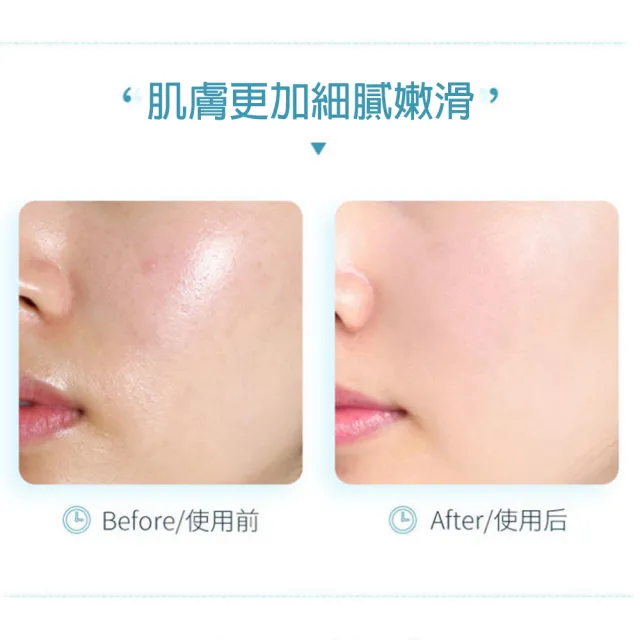 GINBI吟美玻尿酸水潤礦泉噴霧 150ml 3入(化妝水 保濕 玻尿酸)