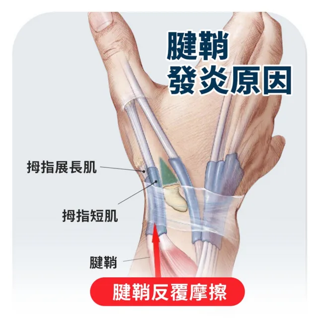 【homer生活家】拇指護腕(支撐護腕 護腕 固定拇指 拇指護腕 拇指 拇指肌腱)