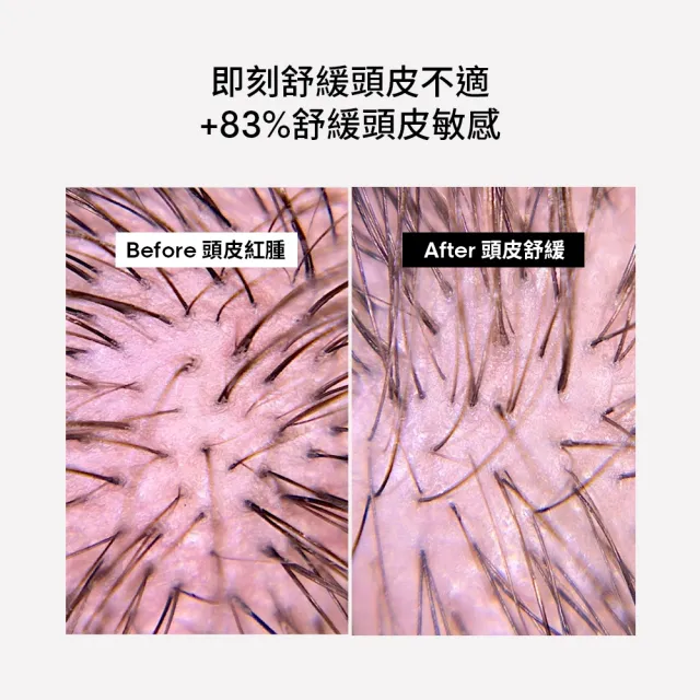 【L’OREAL 巴黎萊雅PRO】絲漾博瞬效敏弱修護洗髮精500ml(舒敏/保濕)