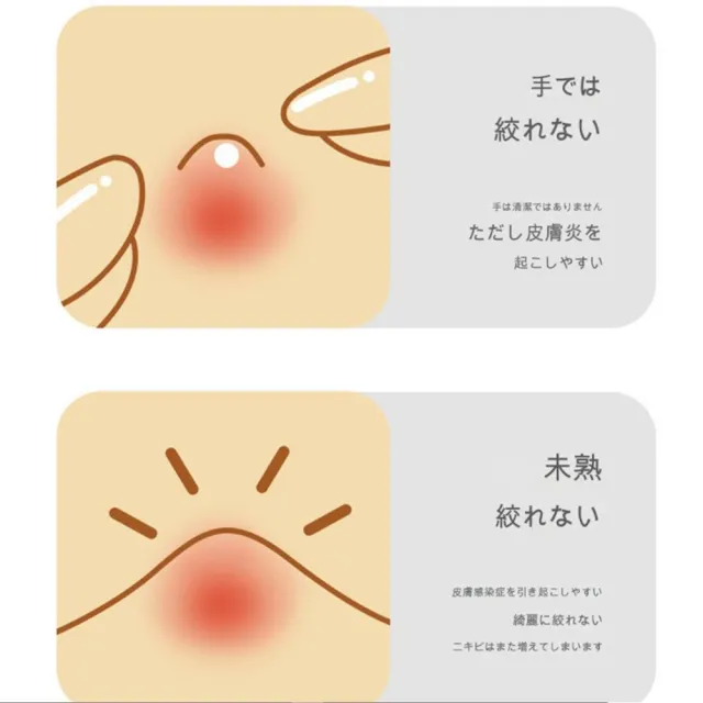 【DIVA】日式冶亮質感高聚焦專注粉刺處理照射燈(粉刺夾 粉刺針 粉刺燈)