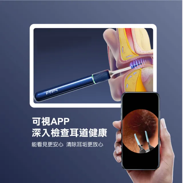 【BEBIRD】Note5可視採耳棒(採耳 挖耳棒 挖耳勺 掏耳棒 採耳 挖耳 鑷子夾 棉花棒)