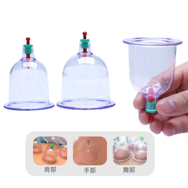 【九珍】簡易型拔罐器(拔罐)