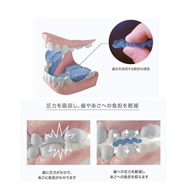【PROIDEA】日本製防磨牙牙套附收納盒 1入(磨牙牙套 夜間牙套 護牙套)