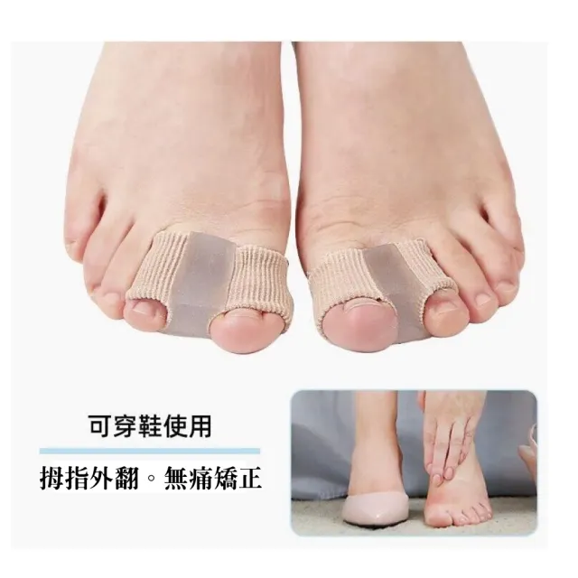 【WARM DAY LIFE】拇指外翻矯正器 買一送一 拇指外翻分支器(腳指外翻矯正器 大拇趾重疊 可穿鞋 分趾器)