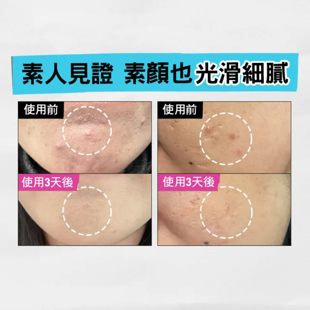【契爾氏】官方直營 激光三酸煥膚精華液 30ml(Kiehl’s/新品上市/無針水光)
