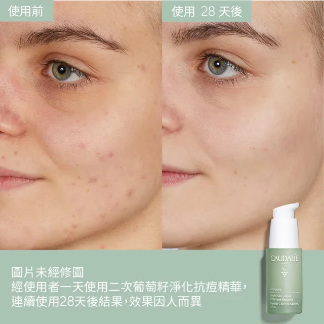 【CAUDALIE 歐緹麗】抗痘精華保濕組(葡萄籽淨化抗痘精華+葡萄籽抗痘控油保濕霜)