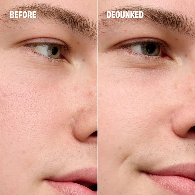 【benefit 貝玲妃】粉刺bye bye刮刮棒(毛孔淨化水凝霜X粉刺清潔刮鏟)