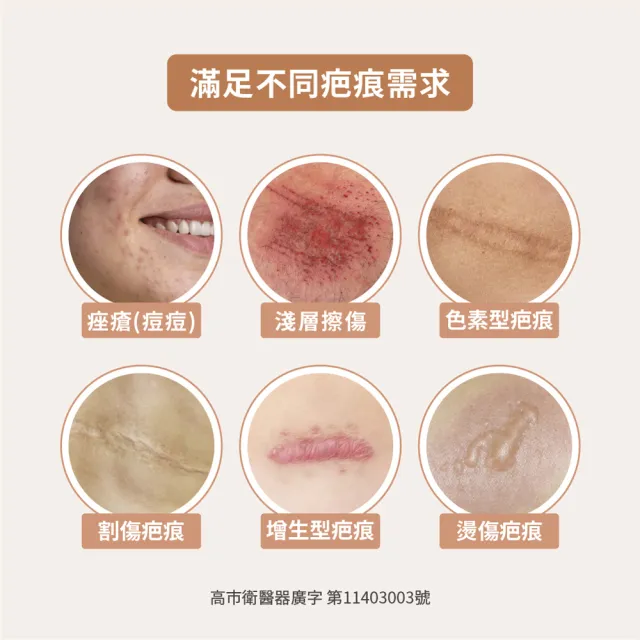 【TAICEND 泰陞】疤痕凝膠(10g-未滅菌)