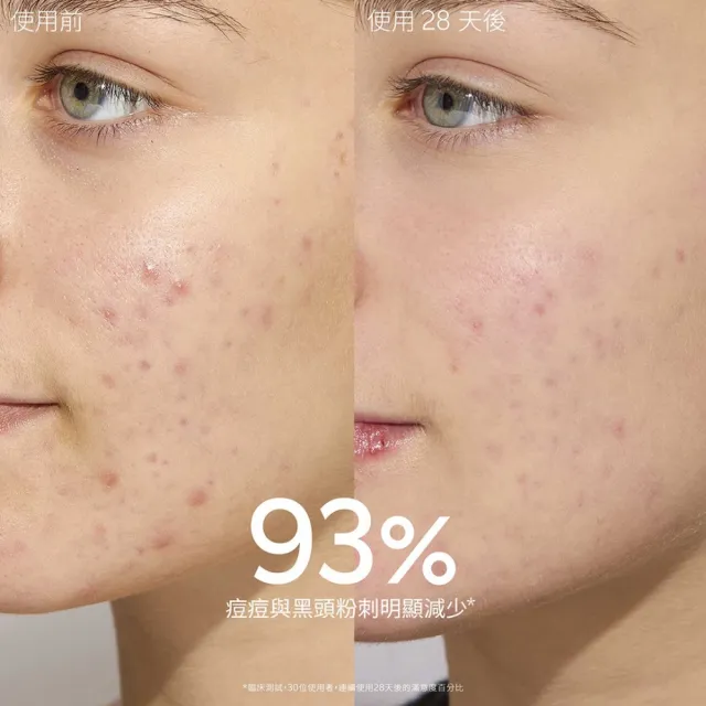 【CAUDALIE 歐緹麗】葡萄籽抗痘控油保濕乳60ml(容量升級組)