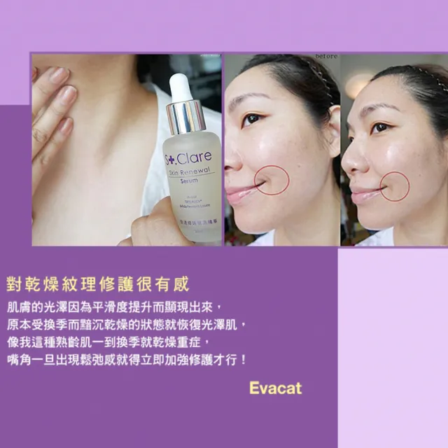 【St.Clare 聖克萊爾】倍速修護賦活精華30mlx2入(抗老/保濕/醫美後修護保養)