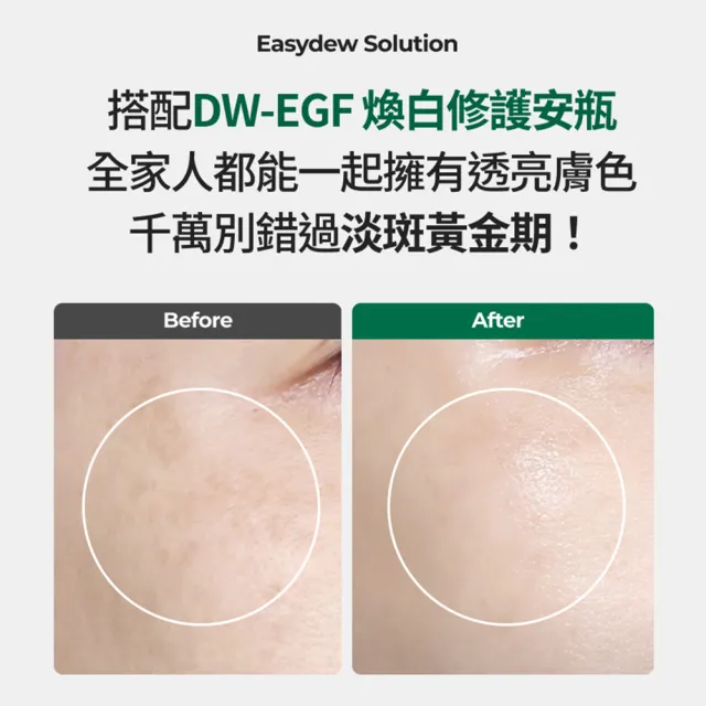 【Easydew】DW-EGF煥白修護安瓶 30ml(#調理斑點 #亮膚精華 #添加高濃度EGF)