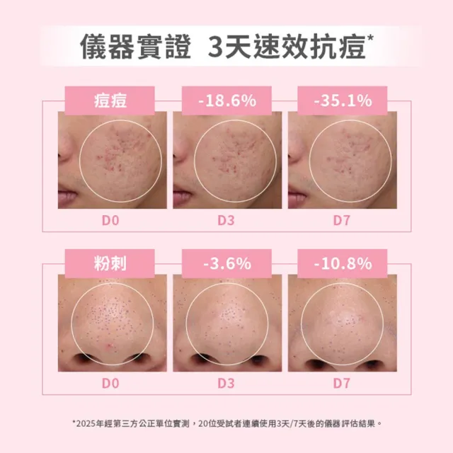 【SHIMBI METHOD 審美之選】15%杜鵑花酸集中抗痘精華