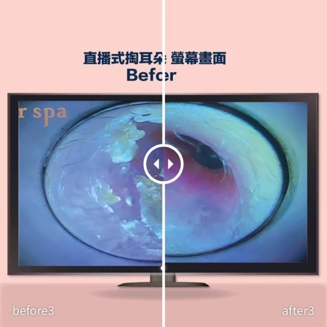 her spa 和和恬｜直播式掏耳朵券 採耳券 掏耳券 采耳券 掏耳朵抵用券 15~30mins
