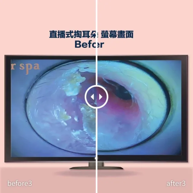 her spa 和和恬|直播式掏耳朵券 採耳券 掏耳券 采耳券 掏耳朵抵用券 15~30mins