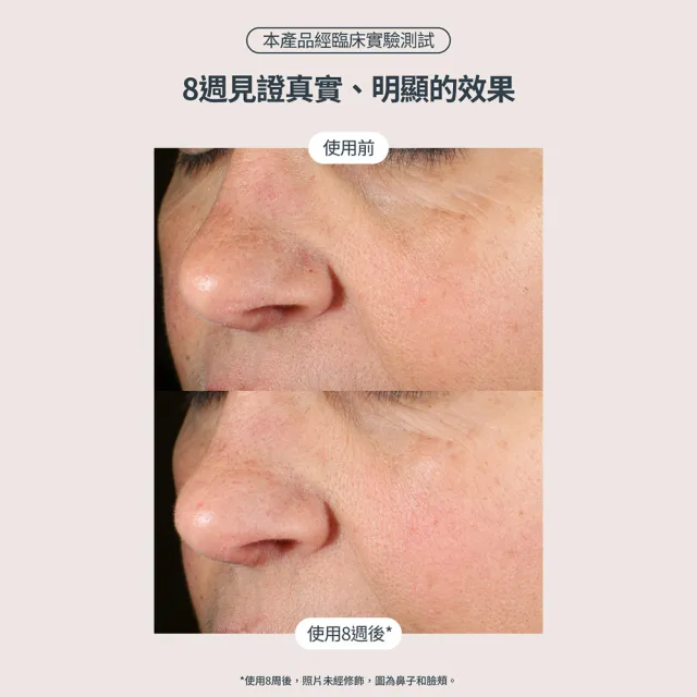 【StriVectin 皺效奇蹟】桃金日限定★皺效緊緻繃繃精華50ml(歐美院線/皮膚科推薦/緊緻肌膚)