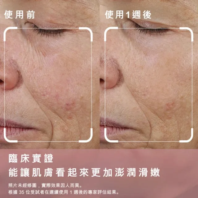 【StriVectin 皺效奇蹟】回春囤貨組★彈力煥白雙星組(胜膠原霜50ml+維他命C晚霜50ml)