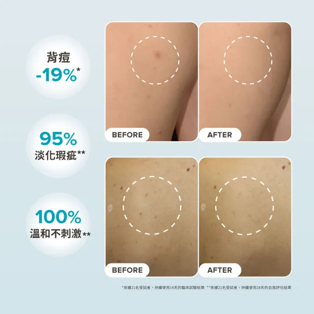 【Paulas Choice 寶拉珍選】淨無痘2％水楊酸美體噴露二入組(去角質/抗痘/美背)