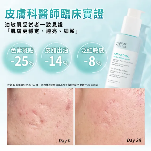 【sensilis 森思黎絲】杜鵑花酸煥膚精華100ml+B5控油舒緩潔顏凝膠 200ml (油痘敏感肌洗面乳+刷酸)