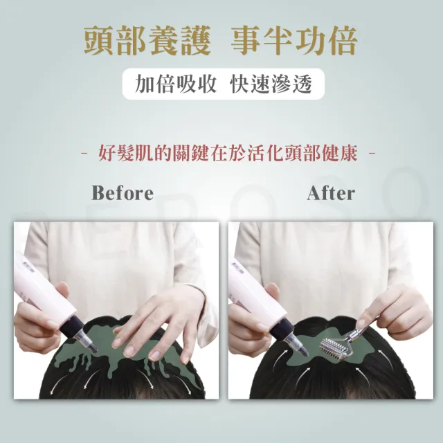 【Beroso 倍麗森】微刺頭部按摩滾輪(頭部按摩器 頭皮SPA 按摩滾輪 T棒 頭部滾輪 美容滾輪 小臉滾輪)