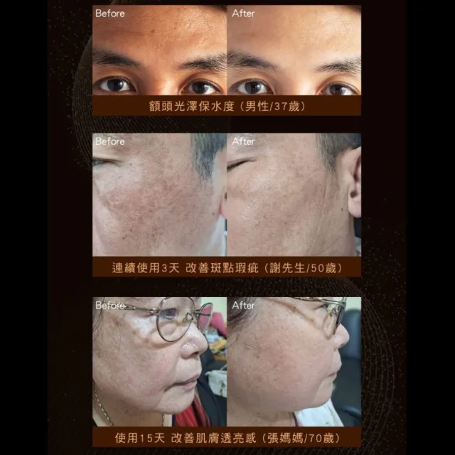 【dr.hold 黛后】絲蛋白超能抗皺精華30ml(保濕 修復 撫紋)