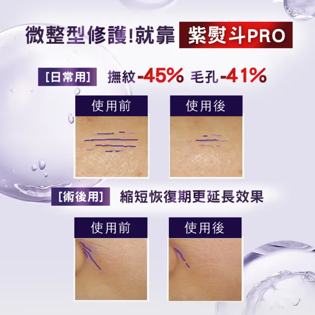 即期品【L’OREAL Paris 巴黎萊雅】買一送一 玻尿酸眼霜級撫紋精華霜30ml(贈玻尿酸眼霜級撫紋精華霜30ml)