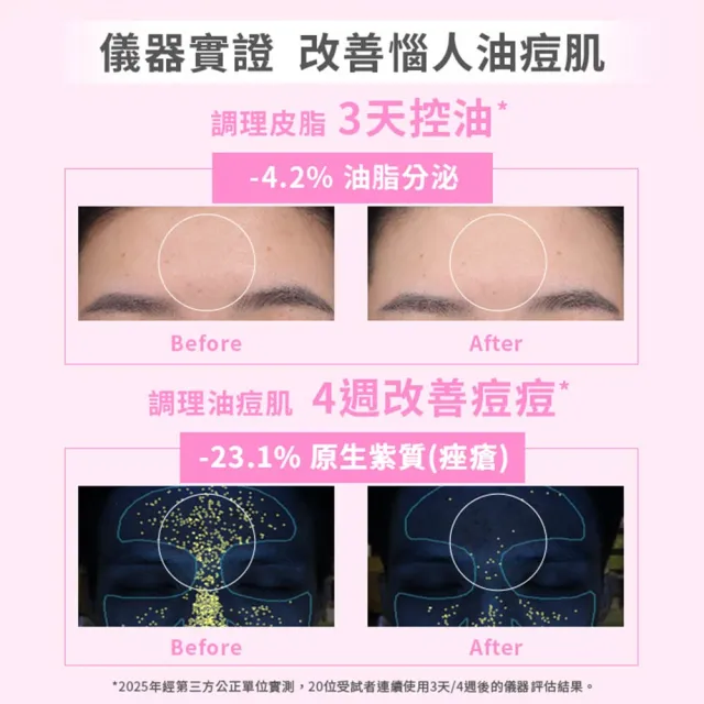 【SHIMBI METHOD 審美之選】5%杜鵑花酸控油煥膚精華2入 雙11限定