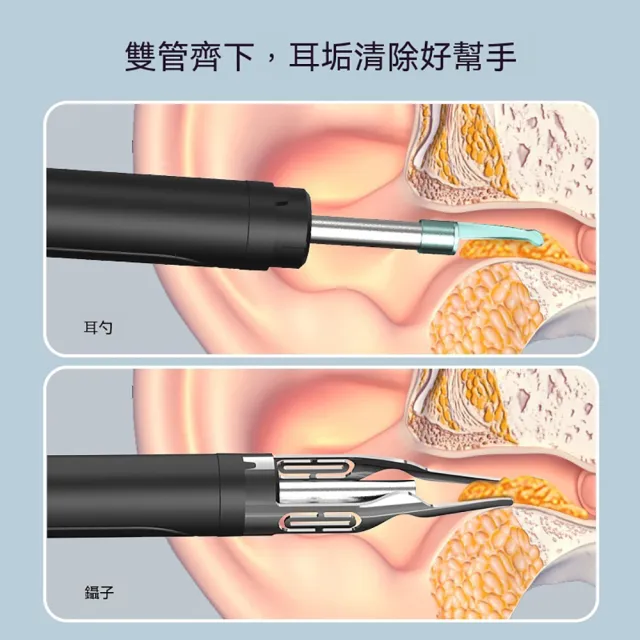 【ELAINE】兒童可視挖耳勺 智能高清可視掏耳棒 發光掏耳朵挖耳勺 可視耳道 軟頭兒童挖耳器 NK3A-JZ