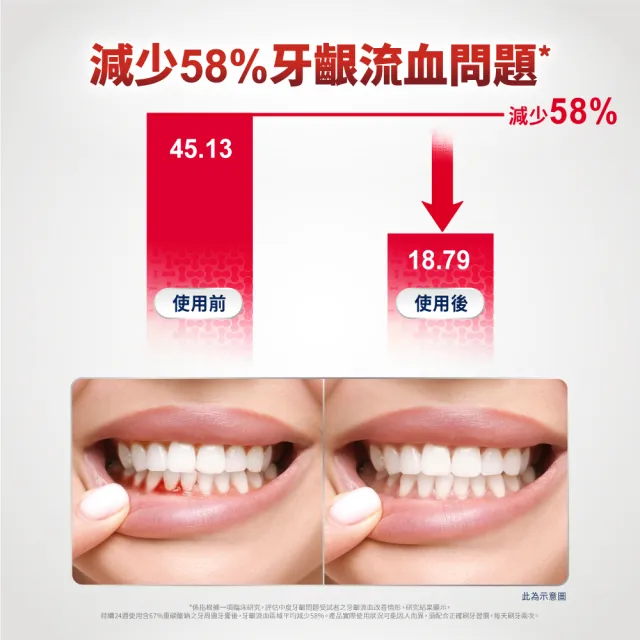 即期品【Parodontax 牙周適】基礎系列 牙齦護理牙膏X6入