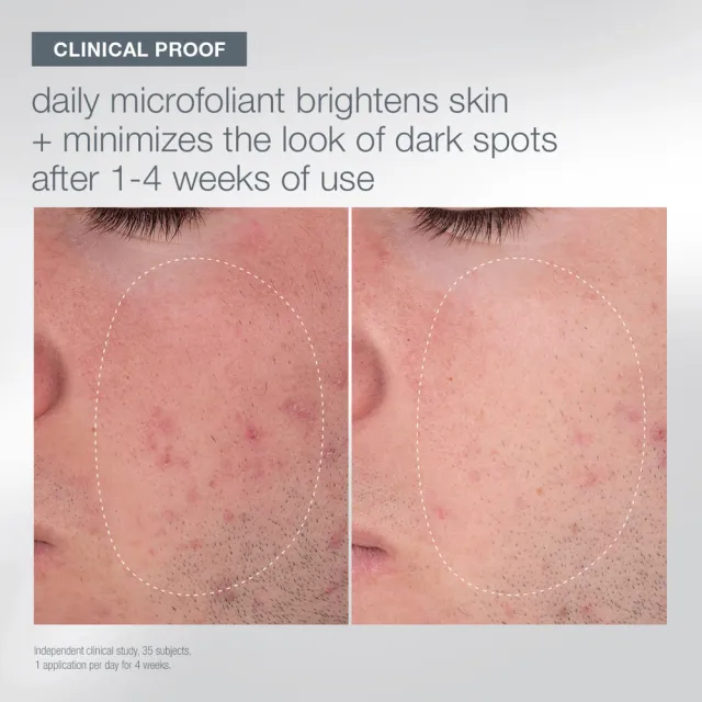【dermalogica 德卡】精微酵素洗顏粉精裝禮盒(74g/德美樂嘉/改善毛孔粗大)