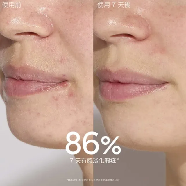 【CAUDALIE 歐緹麗】抗痘精華聯名組(淨化抗痘精華30ml+抗痘控油保濕霜40ml) (momo x KINGJUN美妝聯名袋)