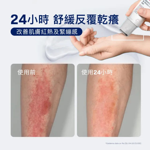 【Cetaphil 舒特膚】官方直營 AD益膚康瞬效舒敏凝膠59ml(新品上市/隨身小冰塊)