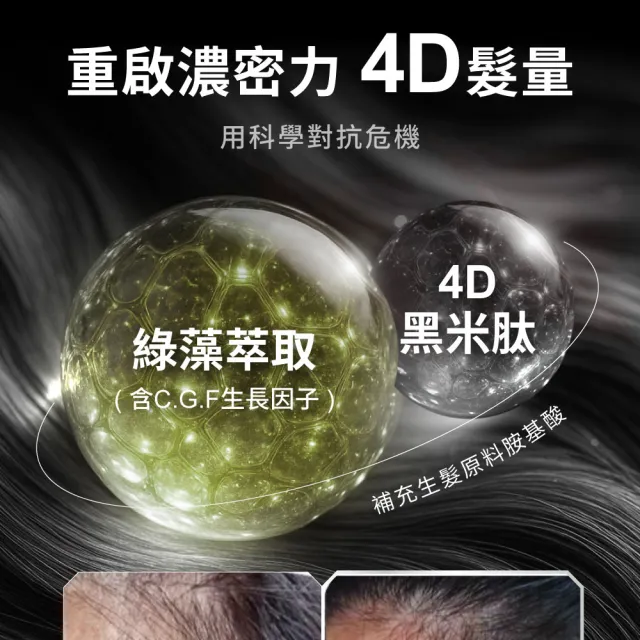 【Relove】4D黑米絲密膠囊60顆X3包 共180顆(每日2顆90天份 天然酵母鋅x酵母硒 穩固防脫髮)