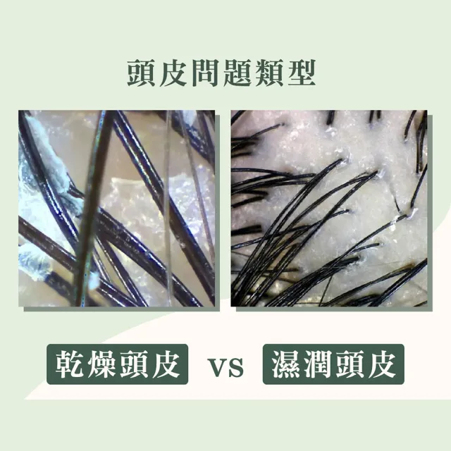 【MG瑪格諾莉雅】北極重生水頭皮精華液-五件組(80mlx5)