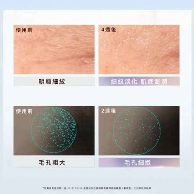 【ELIXIR 怡麗絲爾】彈潤修護水乳組II (精華露+精華乳+A醇精華2g+小金管5ml+精華露18mlx2+精華乳18ml)
