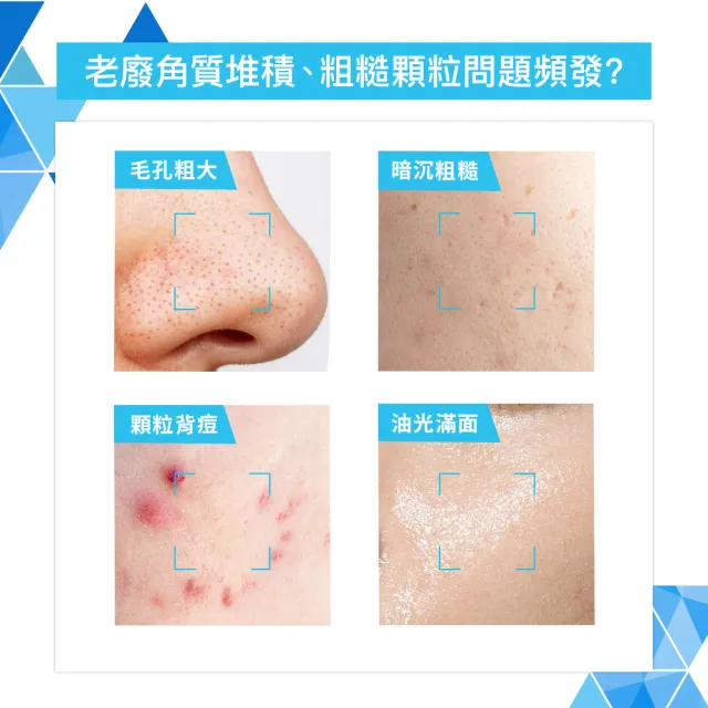 【CeraVe 適樂膚】期間限定特談雙入組★水楊酸煥膚淨嫩潔膚露 473ml X2(改善粗糙顆粒)