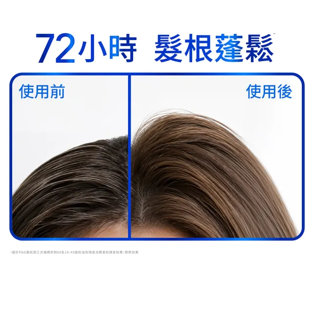 【head＆shoulders 海倫仙度絲】新上市! 頭皮護理洗髮露/洗髮精650g(醫美界成分注入 頭皮肌底瓶)