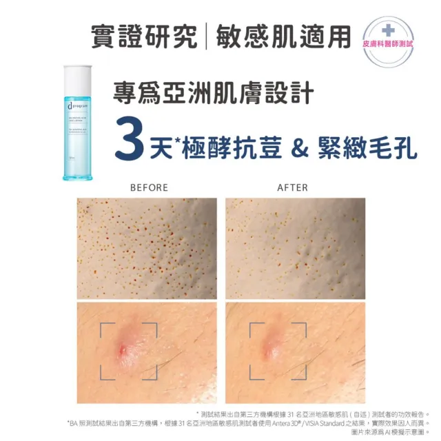 【d program 敏感話題】淨荳極效水潤組 (淨荳精華+保濕水)(敏感肌/敏弱肌/局部痘痘問題)