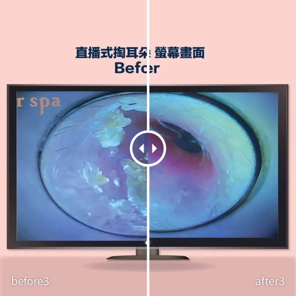 her spa 和和恬|直播式掏耳朵券 採耳券 掏耳券 采耳券 掏耳朵抵用券 15~30mins